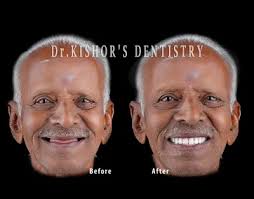 Dr.KISHOR’S DENTISTRY