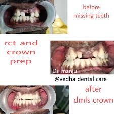Sri Vedha Dental Care