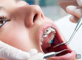 Cuddalore Dental Centre (Dr. R. Narmatha)