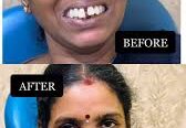 Cuddalore Dental Centre (Dr. R. Narmatha)