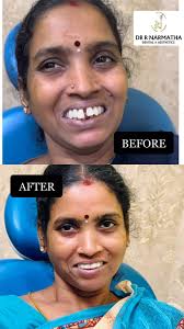 Cuddalore Dental Centre (Dr. R. Narmatha)